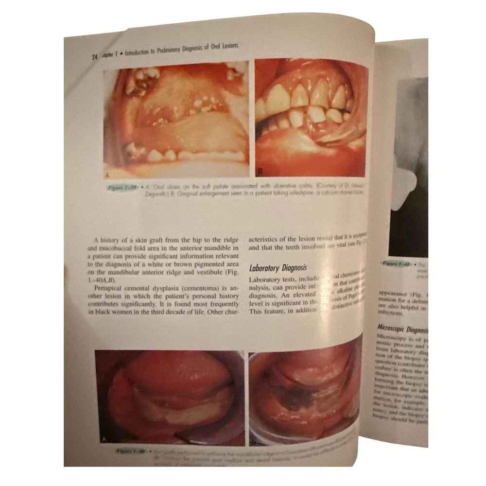 Oral Pathology for the Dental Hygienist Third Edition Textbook Ibsen Phelan